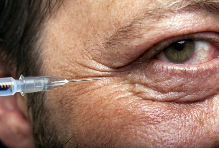 Did you know Botox could be good for the eyes?