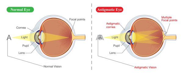 Aveți astigmatism? Treceți testul online pentru a afla | Blog nmforum.ro