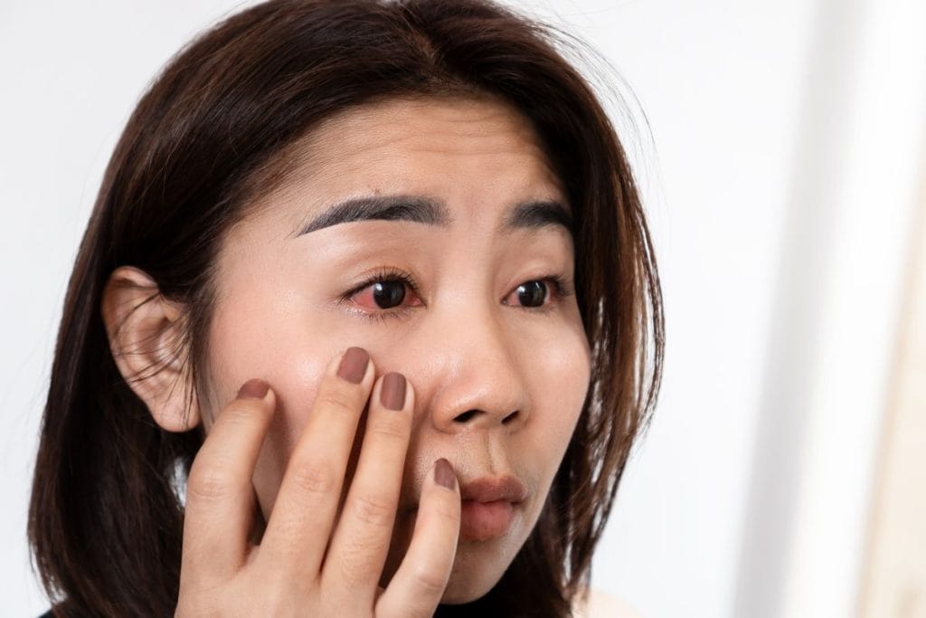 asian-woman-with-inflamed-eyes