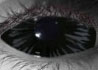 Corvinus-M contact lenses