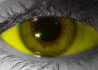 Yellow Sclera contact lenses