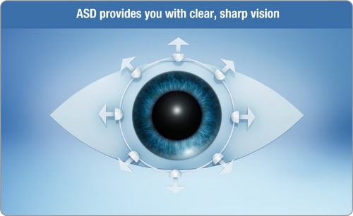 The unique ASD technology ensures clear and stable vision all day. Source: J&J